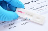 Millions didn’t test positive for COVID-19 they tested positive for a coronavirus Germany synthesized to obtain $billions Millions didn’t test positive for COVID-19 they tested positive for a coronavirus Germany synthesized to obtain $billions